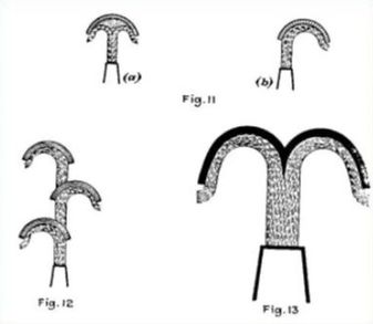 Patent drawing of various Pelton  bucket designs.